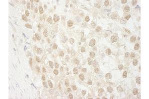 anti-Metastasis Associated 1 Family, Member 3 (MTA3) (AA 400-450) antibody
