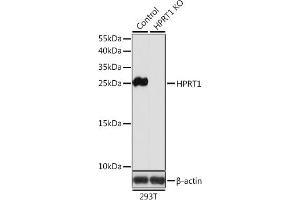 Western blot analysis of extracts from normal (control) and HPRT1 knockout (KO) 293T cells, using HPRT1 antibody (ABIN6132283, ABIN6141970, ABIN6141971 and ABIN7101782) at 1:1000 dilution. (HPRT1 Antikörper  (AA 1-218))
