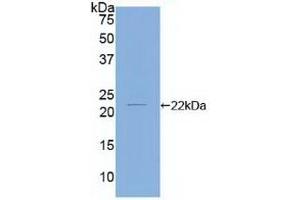 Detection of Recombinant CFL2, Human using Polyclonal Antibody to Cofilin 2, Muscle (CFL2) (Cofilin 2 Antikörper  (AA 1-156))