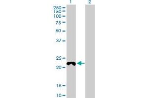 Western Blot analysis of COX4NB expression in transfected 293T cell line by COX4NB MaxPab polyclonal antibody. (COX4NB Antikörper  (AA 1-210))