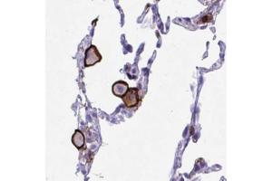 Immunohistochemical staining (Formalin-fixed paraffin-embedded sections) of human lung with SPN polyclonal antibody  shows strong membranous positivity in a subset of macrophages and pneumocytes. (CD43 Antikörper  (AA 315-394))