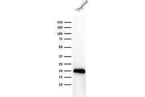 Western Blotting (WB) image for anti-CD3 epsilon (CD3E) (AA 156-168), (Cytoplasmic Domain) antibody (ABIN6941021)