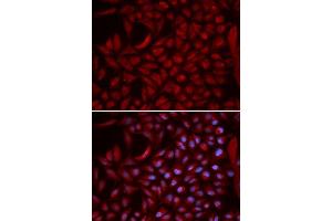 Immunofluorescence analysis of U2OS cells using CUL5 antibody. (Cullin 5 Antikörper  (AA 1-300))