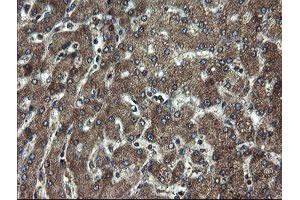 Immunohistochemical staining of paraffin-embedded Human liver tissue using anti-DOK7 mouse monoclonal antibody. (DOK7 Antikörper)