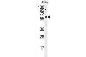 Western Blotting (WB) image for anti-PARP1 Binding Protein (PARPBP) antibody (ABIN2995516) (PARPBP Antikörper)