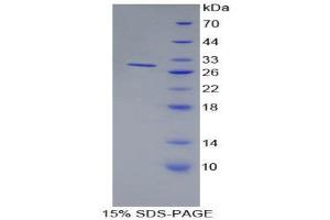 SDS-PAGE (SDS) image for Bone Marrow Stromal Cell Antigen 1 (BST1) (AA 63-313) protein (His tag) (ABIN2124136)