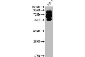 Western Blot Positive WB detected in: PC-3 whole cell lysate All lanes: PCSK9 antibody at 1:2000 Secondary Goat polyclonal to rabbit IgG at 1/50000 dilution Predicted band size: 75, 21 kDa Observed band size: 60, 75 kDa