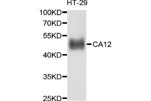 Western blot analysis of extracts of HT-29 cells, using CA12 antibody (ABIN5997338) at 1/1000 dilution. (CA12 Antikörper)