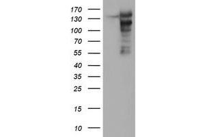Western Blotting (WB) image for anti-ATP/GTP Binding Protein 1 (AGTPBP1) (AA 368-753) antibody (ABIN1491460)