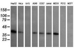 Image no. 2 for anti-Mitogen-Activated Protein Kinase Kinase 3 (MAP2K3) antibody (ABIN1499415) (MAP2K3 Antikörper)