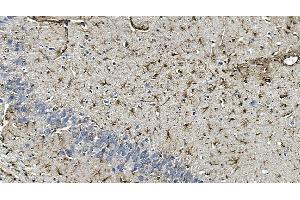 IHC analysis of GFAP using anti-GFAP antibody (ABIN7602675). (GFAP Antikörper  (AA 93-432))