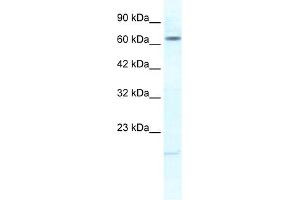 WB Suggested Anti-KCNH6 Antibody Titration:  1. (KCNH6 Antikörper  (N-Term))