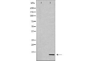 Western blot analysis of Hela whole cell lysates, using Histone H4K20me3 Antibody. (Histone H4 Antikörper  (3meLys20))