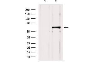 Western blot analysis of extracts from Hela, using CBS Antibody. (CBS Antikörper  (Internal Region))