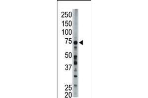 Antibody is used in Western blot to detect FACL6 in mouse liver tissue lysate.