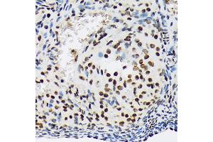 Immunohistochemistry of paraffin-embedded rat ovary using SF3B1 Rabbit mAb (ABIN7270542) at dilution of 1:100 (40x lens). (SF3B1 Antikörper)