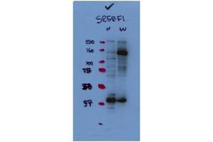 WB Suggested Antibody Titration:  1:1,000   Positive Control:  HepG2 (SREBF1 Antikörper  (N-Term))