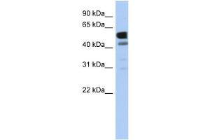 WB Suggested Anti-LDHD Antibody Titration: 0.