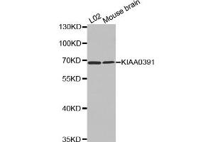 Western Blotting (WB) image for anti-KIAA0391 (KIAA0391) antibody (ABIN1875480) (KIAA0391 Antikörper)