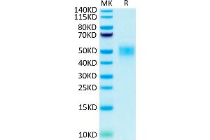Biotinylated Human Fc gamma RIIIB (NA2) on Tris-Bis PAGE under reduced condition. (FCGR3B Protein (His-Avi Tag,Biotin))