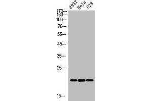 Western Blot analysis of 293T Hela 823 cells using ANG I Polyclonal Antibody (ANG Antikörper  (N-Term))