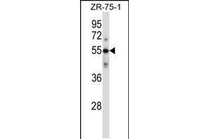 Western blot analysis in ZR-75-1 cell line lysates (35ug/lane). (C9 Antikörper  (AA 191-220))