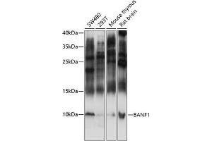 Western blot analysis of extracts of various cell lines, using B antibody (ABIN7265827) at 1:3000 dilution. (BANF1 Antikörper  (AA 1-89))