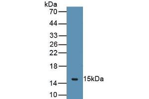 Detection of Recombinant CHRM3, Human using Polyclonal Antibody to Cholinergic Receptor, Muscarinic 3 (CHRM3) (CHRM3 Antikörper  (AA 1-104))