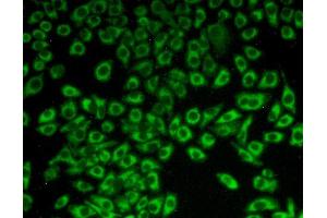 Figure:FITC staining on IHC-P Simple: Hela cells (C1QBP Antikörper  (AA 71-278))