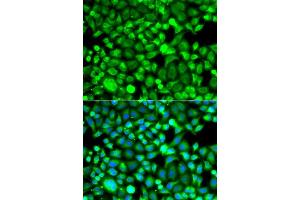 Immunofluorescence analysis of A549 cells using PSMB8 antibody. (PSMB8 Antikörper  (AA 163-272))