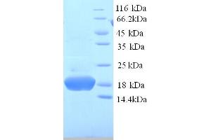 SDS-PAGE (SDS) image for phosphohistidine Phosphatase 1 (PHPT1) (AA 1-125), (full length) protein (His tag) (ABIN5713724)