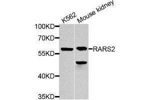 Western blot analysis of extracts of K562 and mouse kidney cells, using RARS2 antibody. (RARS2 Antikörper)
