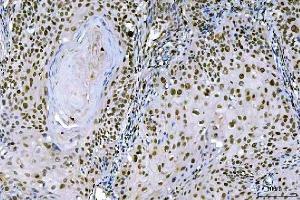IHC analysis of Ki67/MKI67 using anti-Ki67/MKI67 antibody (ABIN7601873).