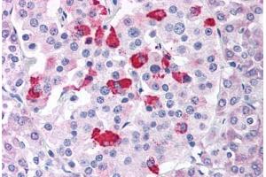 Pancreas (BACE1 Antikörper  (Internal Region))