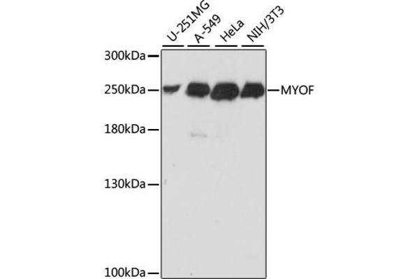 Myoferlin Antikörper  (AA 1-190)