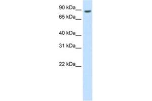 Western Blotting (WB) image for anti-BRF1, RNA polymerase III transcription initiation factor subunit (BRF1) antibody (ABIN2462032)