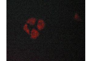 ABIN6269097 staining Hela cells by ICC/IF. (KRT8 Antikörper  (C-Term))