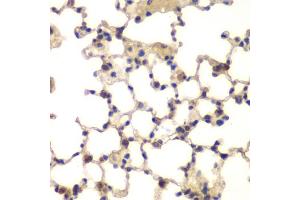 Immunohistochemistry of paraffin-embedded mouse lung using CXXC1 antibody.