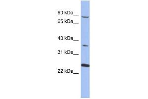 Western Blotting (WB) image for anti-Membrane Protein, Palmitoylated 3 (MAGUK P55 Subfamily Member 3) (MPP3) (N-Term) antibody (ABIN2786645)