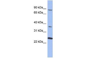 WB Suggested Anti-MPP3  Antibody Titration: 0. (MPP3 Antikörper  (N-Term))