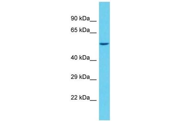SAMD1 Antikörper  (C-Term)