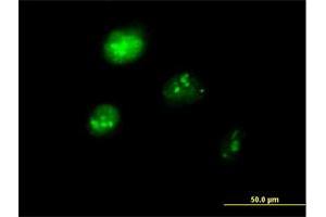 Immunofluorescence of purified MaxPab antibody to IRF1 on HeLa cell. (IRF1 Antikörper  (AA 1-325))