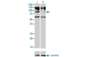 Western blot analysis of IL31RA over-expressed 293 cell line, cotransfected with IL31RA Validated Chimera RNAi (Lane 2) or non-transfected control (Lane 1). (IL31RA Antikörper  (AA 21-120))
