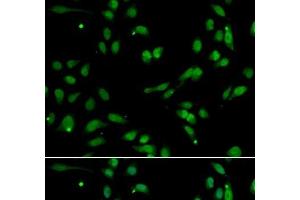 Immunofluorescence analysis of A549 cells using ANP32A Polyclonal Antibody (PHAP1 Antikörper)
