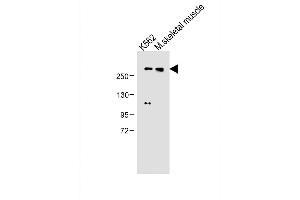 All lanes : Anti-ADTS13 Antibody (Center) at 1:500 dilution Lane 1: K562 whole cell lysate Lane 2: M. (ADAMTS13 Antikörper  (AA 829-858))
