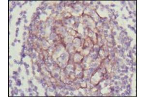 Immunohistochemical analysis of paraffin-embedded human lymph node using NTRK3 mouse mAb with DAB staining.