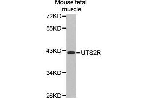 Western Blotting (WB) image for anti-Urotensin 2 Receptor (UTS2R) (AA 280-389) antibody (ABIN6219939) (UTS2R Antikörper  (AA 280-389))