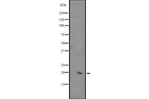 Western blot analysis of SIVA expression in HEK293 cells ,The lane on the left is treated with the antigen-specific peptide. (SIVA1 Antikörper  (Internal Region))