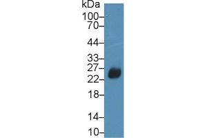 Western Blot; Sample: Rat Spleen lysate; Primary Ab: 2µg/ml Rabbit Anti-Rat SIT1 Antibody Second Ab: 0. (DFFA Antikörper  (AA 19-262))