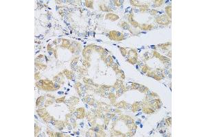 Immunohistochemistry of paraffin-embedded human stomach using ATPIF1 antibody at dilution of 1:100 (x40 lens).
